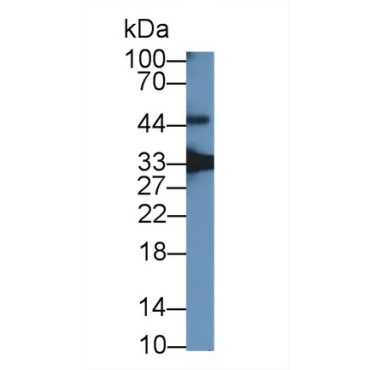 Growth Differentiation Factor 15 (GDF15) Human Polyclonal Antibody