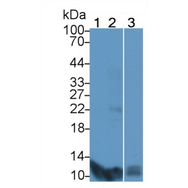 S100 Calcium Binding Protein A7 (S100A7) Bovine (Cattle) Polyclonal Antibody