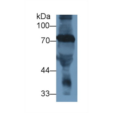 Transferrin (TF) Human Polyclonal Antibody