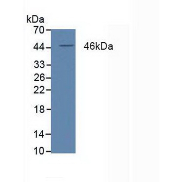 Peroxisome Proliferator Activated Receptor Delta (PPARd) Human Polyclonal Antibody
