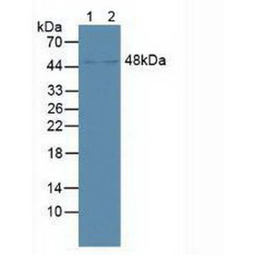 Farnesoid X Receptor (FXR) Human Polyclonal Antibody