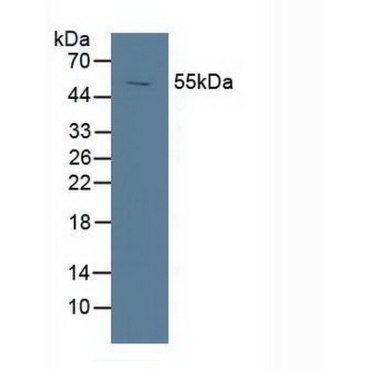 Liver X Receptor Alpha (LXRa) Human Polyclonal Antibody