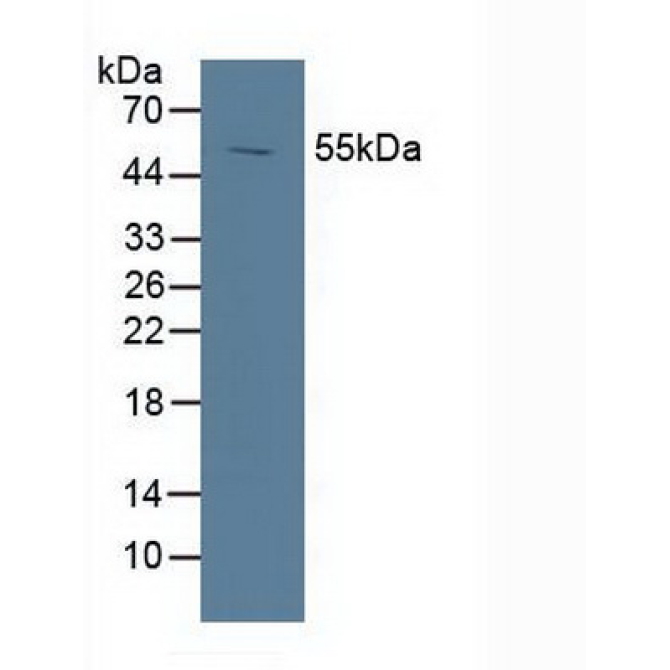 Liver X Receptor Alpha (LXRa) Human Polyclonal Antibody