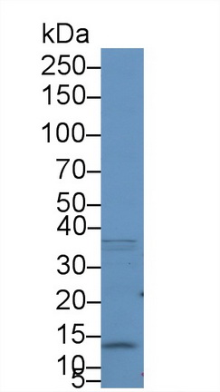 S100 Calcium Binding Protein A10 (S100A10) Human Polyclonal Antibody