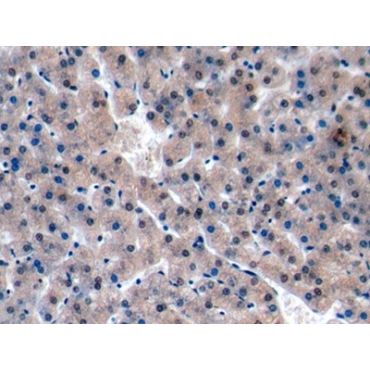Ki-67 Protein (Ki-67) Human Polyclonal Antibody