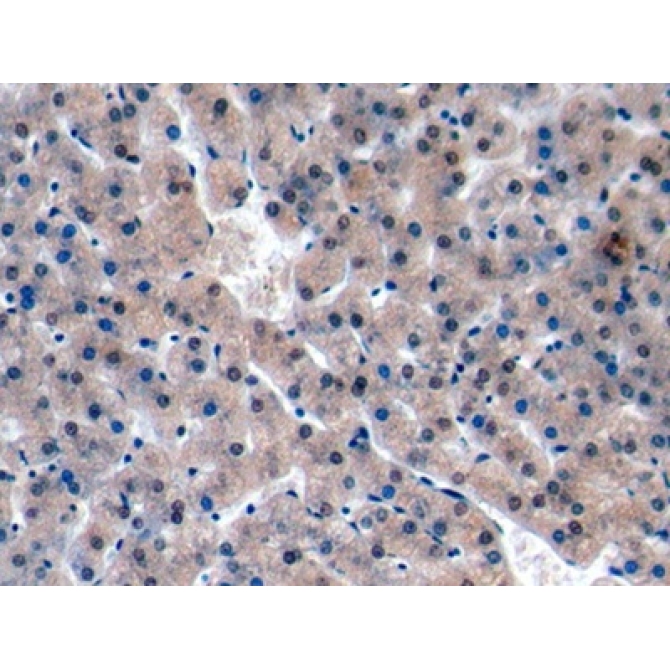 Ki-67 Protein (Ki-67) Human Polyclonal Antibody