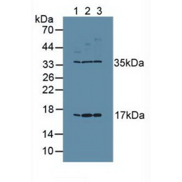 Ki-67 Protein (Ki-67) Human Polyclonal Antibody