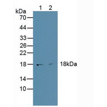 High Mobility Group AT Hook Protein 1 (HMGA1) Human Polyclonal Antibody