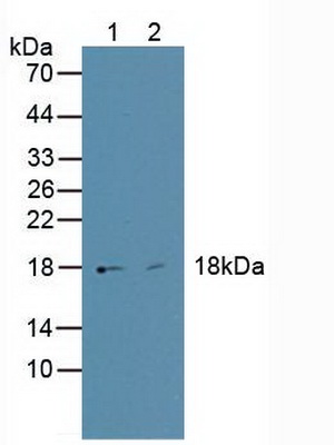High Mobility Group AT Hook Protein 1 (HMGA1) Human Polyclonal Antibody