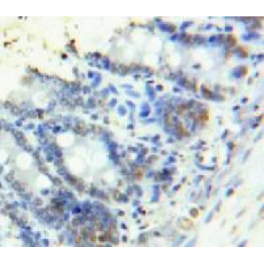High Mobility Group AT Hook Protein 1 (HMGA1) Mouse Polyclonal Antibody