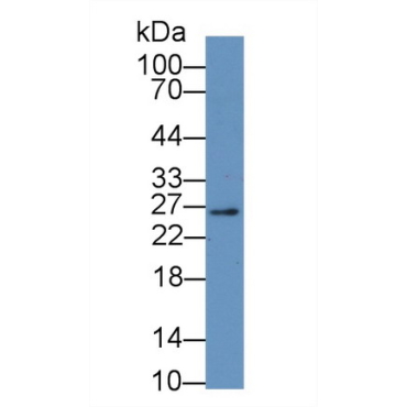 High Mobility Group Box Protein 2 (HMGB2) Human Polyclonal Antibody