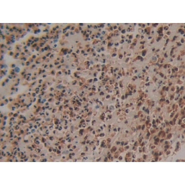 S100 Calcium Binding Protein P (S100P) Human Polyclonal Antibody