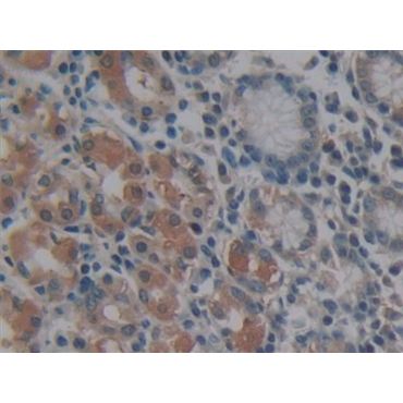 Matrix Metalloproteinase 14 (MMP14) Human Polyclonal Antibody