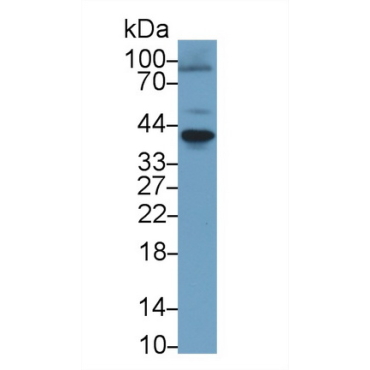 Receptor Activator Of Nuclear Factor Kappa B (RANk) Human Polyclonal Antibody