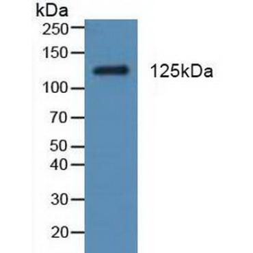 Platelet Derived Growth Factor Receptor Alpha (PDGFRa) Human Polyclonal Antibody