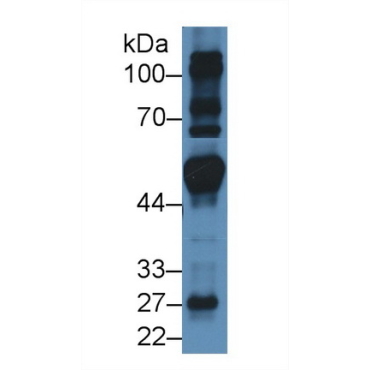 Fibroblast Growth Factor Receptor Substrate 2 (FRS2) Human Polyclonal Antibody