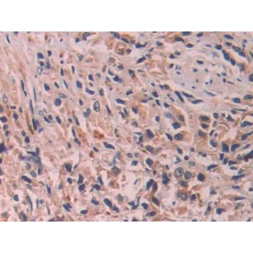 Interleukin 24 (IL24) Human Polyclonal Antibody