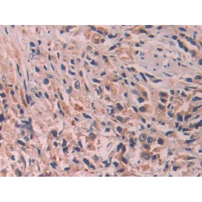 Interleukin 24 (IL24) Human Polyclonal Antibody