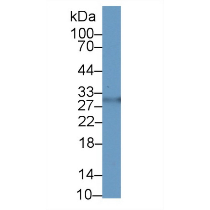 Asialoglycoprotein Receptor 2 (ASGR2) Human Polyclonal Antibody