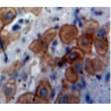 Interferon Inducible T-Cell Alpha Chemoattractant (ITaC) Human Polyclonal Antibody