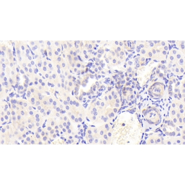 Interferon Inducible T-Cell Alpha Chemoattractant (ITaC) Human Polyclonal Antibody