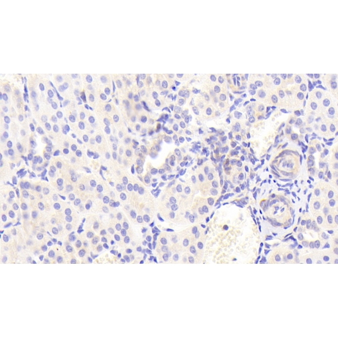 Interferon Inducible T-Cell Alpha Chemoattractant (ITaC) Human Polyclonal Antibody