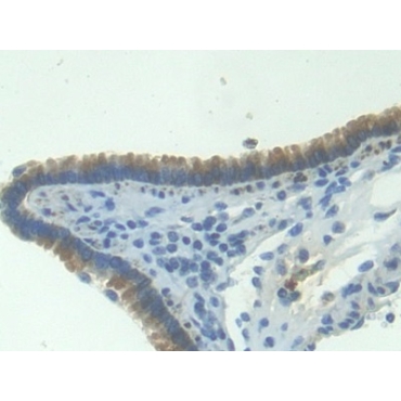 Interferon Inducible T-Cell Alpha Chemoattractant (ITaC) Mouse Polyclonal Antibody