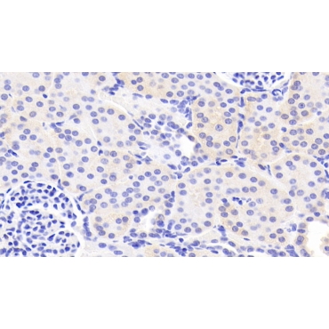 Laminin Alpha 3 (LAMa3) Human Polyclonal Antibody