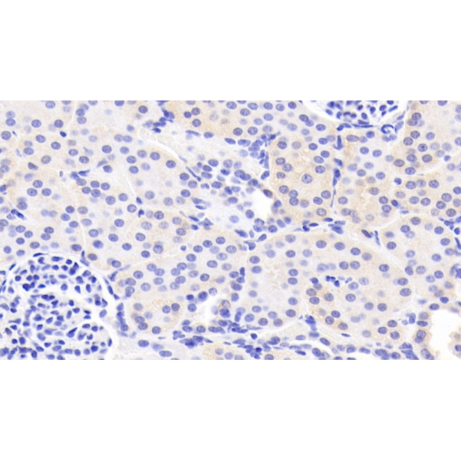 Laminin Alpha 3 (LAMa3) Human Polyclonal Antibody
