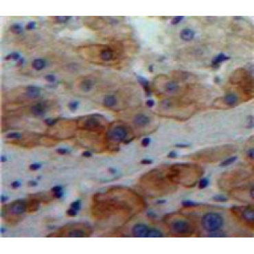 Laminin Alpha 4 (LAMa4) Human Polyclonal Antibody