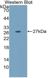 Laminin Alpha 5 (LAMa5) Mouse Polyclonal Antibody