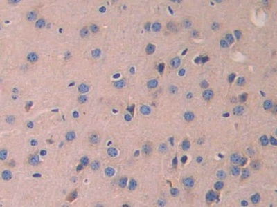 Laminin Beta 2 (LAMb2) Mouse Polyclonal Antibody