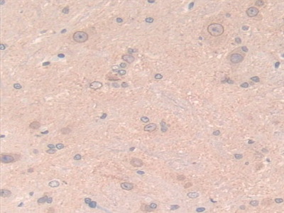 Laminin Beta 2 (LAMb2) Rat Polyclonal Antibody