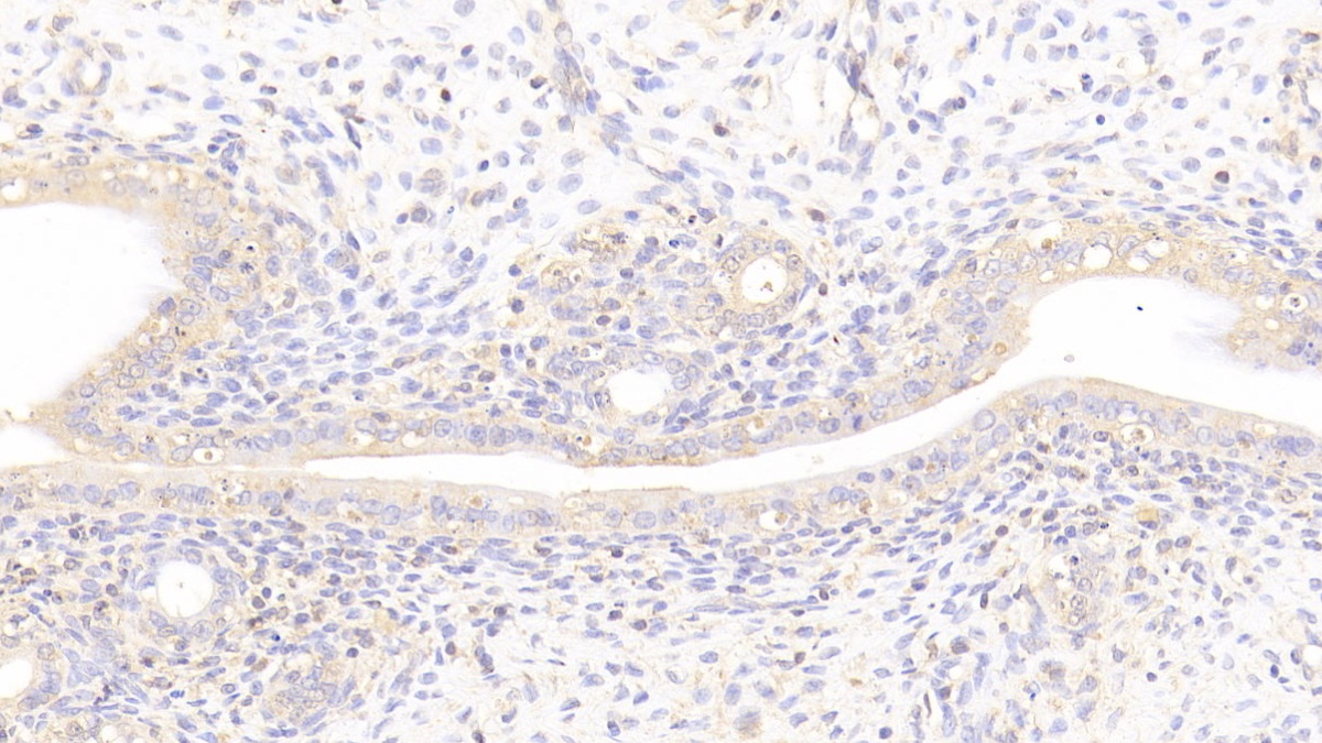Laminin Beta 2 (LAMb2) Rat Polyclonal Antibody
