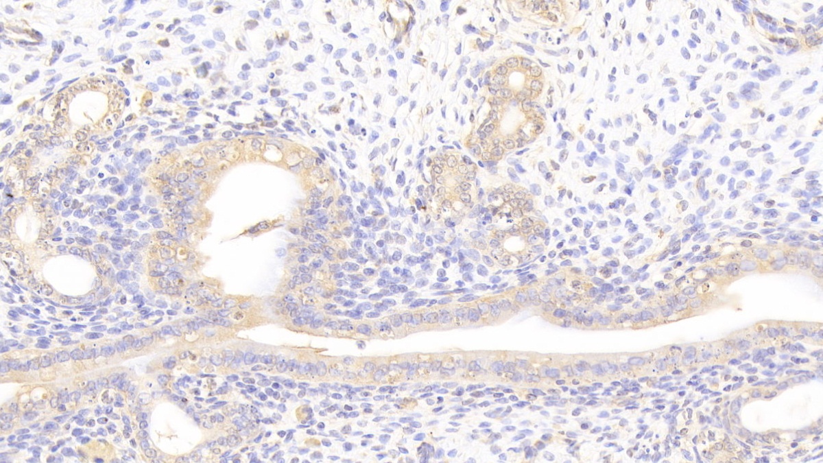 Laminin Beta 2 (LAMb2) Rat Polyclonal Antibody