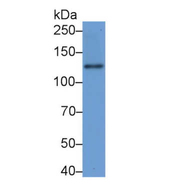 Laminin Beta 3 (LAMb3) Human Polyclonal Antibody