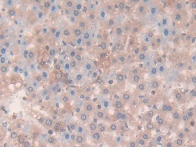 Laminin Beta 3 (LAMb3) Rat Polyclonal Antibody