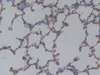 Laminin Gamma 1 (LAMC1) Rat Polyclonal Antibody
