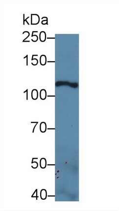 Laminin Gamma 2 (LAMC2) Human Polyclonal Antibody