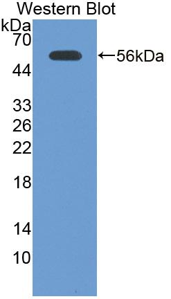 Laminin Gamma 2 (LAMC2) Human Polyclonal Antibody