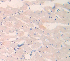 Laminin Gamma 2 (LAMC2) Rat Polyclonal Antibody