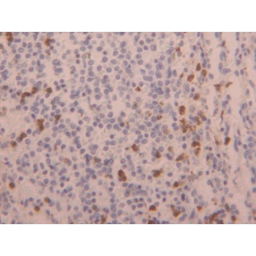 Laminin Gamma 3 (LAMC3) Mouse Polyclonal Antibody