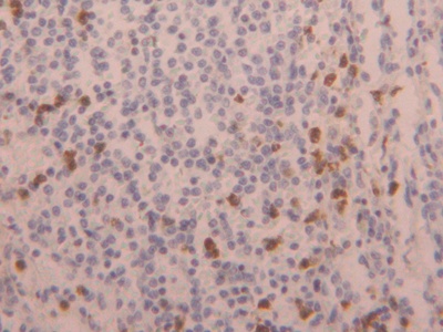 Laminin Gamma 3 (LAMC3) Mouse Polyclonal Antibody