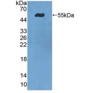 Integrin Alpha 9 (ITGa9) Human Polyclonal Antibody