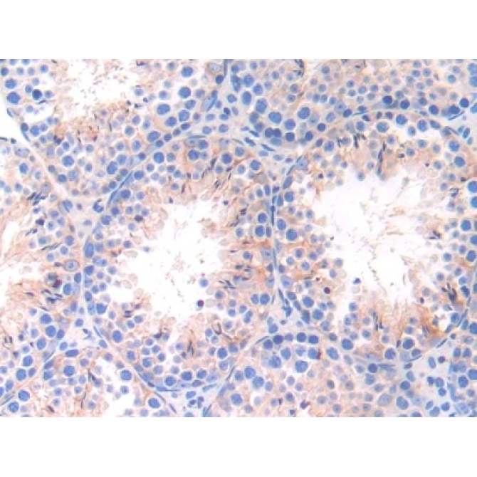 Integrin Alpha 9 (ITGa9) Mouse Polyclonal Antibody