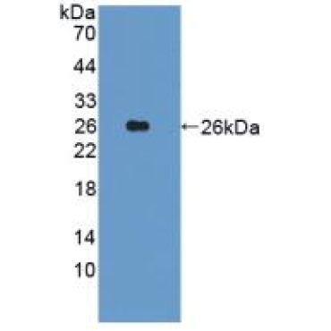 Integrin Alpha 10 (ITGa10) Human Polyclonal Antibody