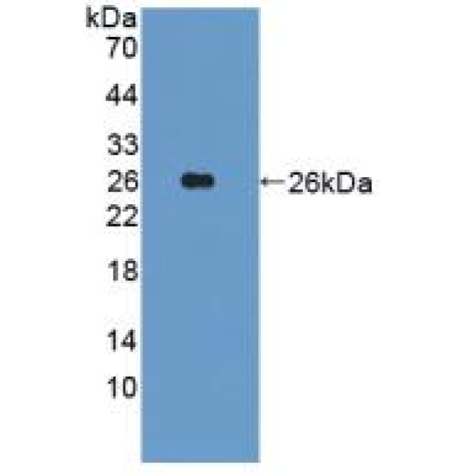 Integrin Alpha 10 (ITGa10) Human Polyclonal Antibody