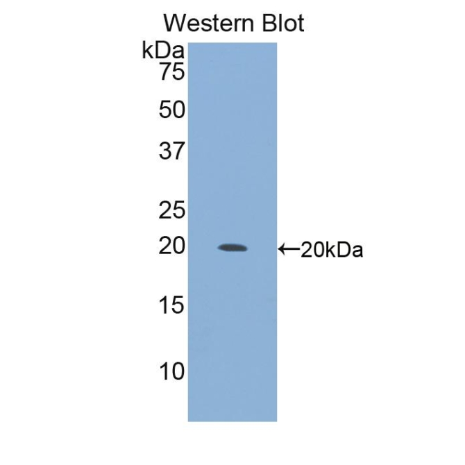 Integrin Alpha 10 (ITGa10) Mouse Polyclonal Antibody