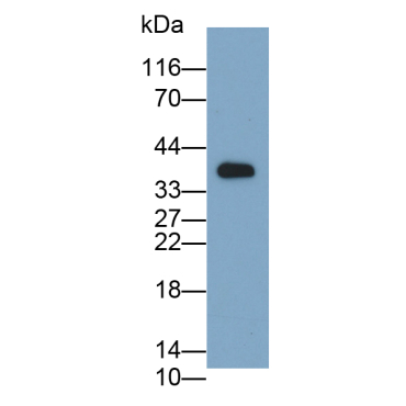Integrin Alpha 11 (ITGa11) Human Polyclonal Antibody