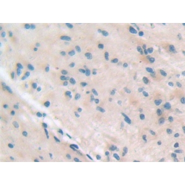 Integrin Beta 5 (ITGb5) Human Polyclonal Antibody